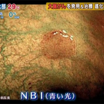 NBI-3